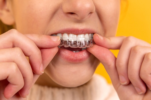 How To Decide If Clear Aligners Are The Right Orthodontic Treatment For You