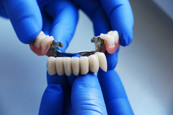 How Many Missing Teeth Can A Dental Bridge Replace?