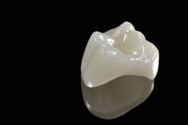 Can A Dental Crown Break?