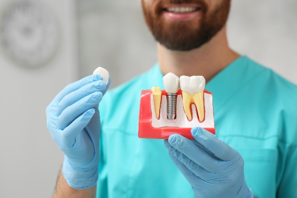 How Natural Does An Implant Crown Look?