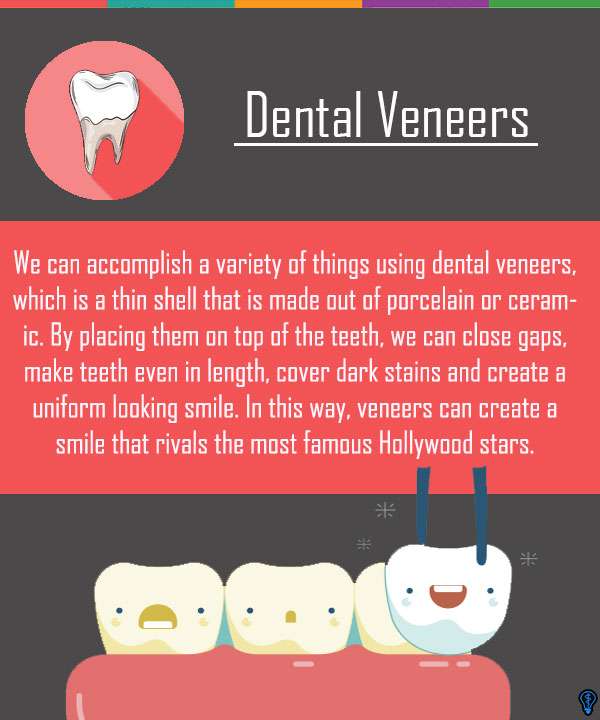 Dental Veneers and Dental Laminates Houston, TX