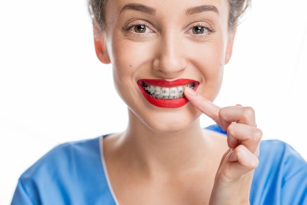 Quick Guide To Fastbraces® For Adult Teeth Straightening