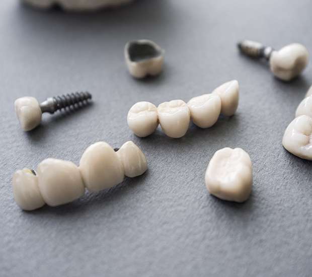 Houston The Difference Between Dental Implants and Mini Dental Implants