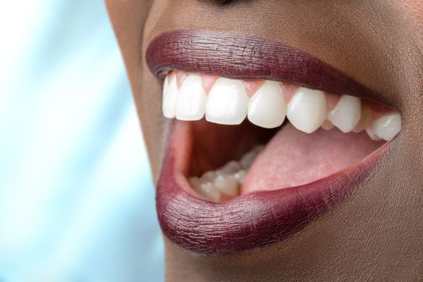How To Minimize Sensitivity After Teeth Whitening